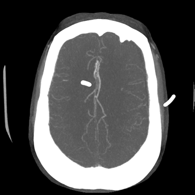 CTA head (MIP) 16/17